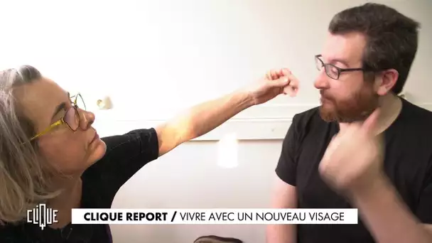 Vivre avec un nouveau visage - CLIQUE REPORT