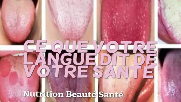 Ce que votre langue dit de votre santé