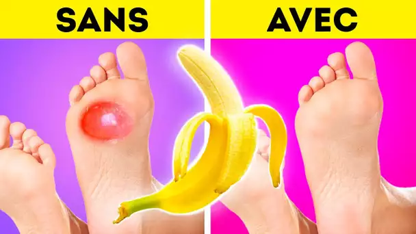 Traitement Incroyable pour les Pieds et Astuces pour Chaussures à Essayer Immédiatement 🦶🏻
