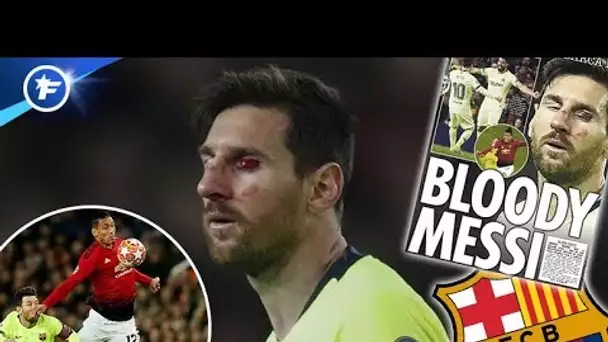 La blessure spectaculaire de Lionel Messi fait les gros titres | Revue de presse