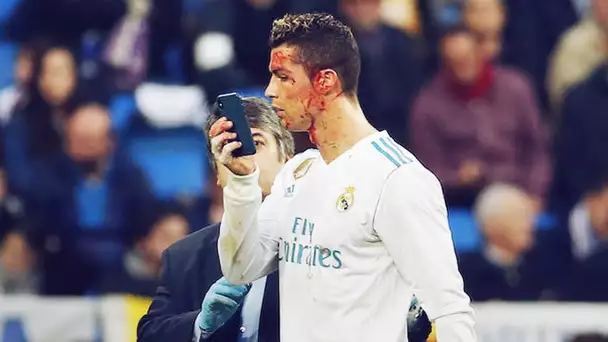 Les 4 pires blessures de la carrière de Cristiano Ronaldo | Oh My Goal