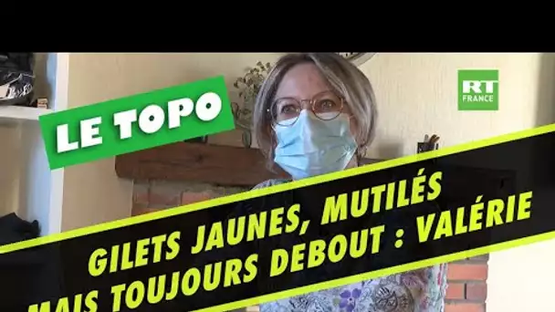 LE TOPO - Gilets jaunes blessés à vie : Valérie