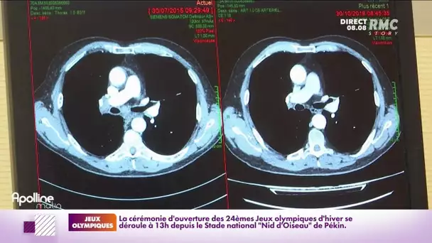 Journée mondiale de lutte contre le cancer : la Haute Autorité de Santé encourage au dépistage