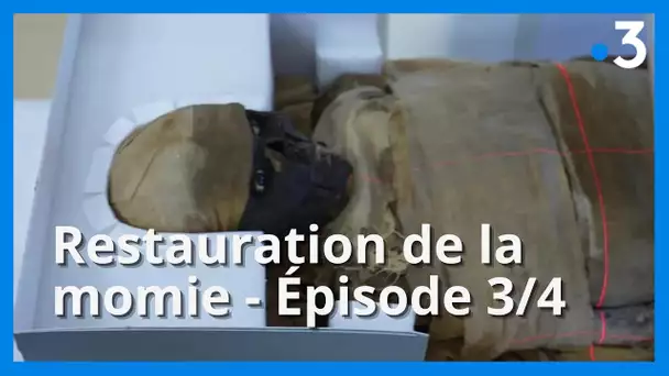 Restauration de la momie du Musée de Picardie : au CHU d'Amiens - Ep. 3/4