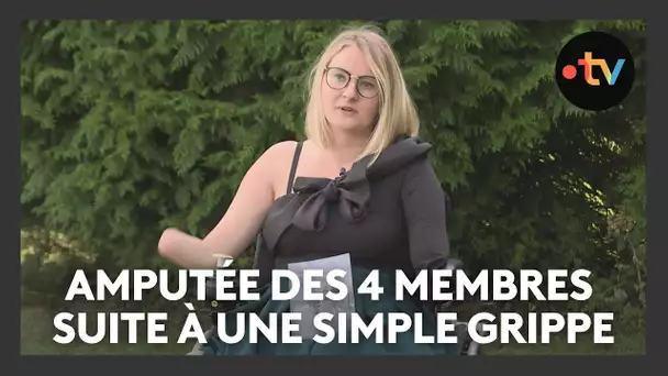 Témoignage : elle perd ses quatre membres à cause d'une bactérie mangeuse de chair