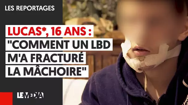 LUCAS*, 16 ANS : "COMMENT UN LBD M'A FRACTURÉ LA MÂCHOIRE"