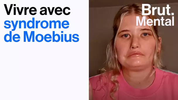 Atteinte du syndrome de Moebius, elle raconte son harcèlement
