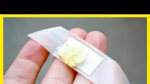 ELLE A MIS DE L’AIL HACHÉ SUR UN BANDAGE…MAIS CE QUI S’EST PASSÉ ENSUITE EST TOUT SIMPLEMENT REMARQ