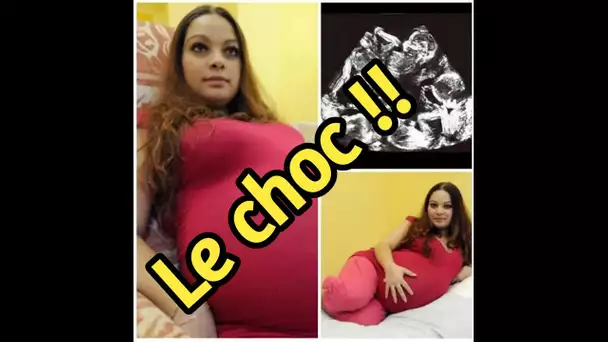 Cette future maman pensait qu’elle attendait des jumeaux. Mais quand elle a vu l’échographie .....