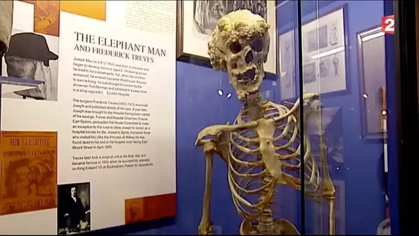 Elephant Man - Les mystères de Londres : Episode 4