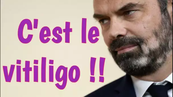 Choc : Édouard Philippe fait une terrible annonce sur sa santé