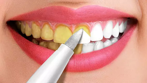 30 Astuces Incroyables Pour Des Dents Bien Blanches || Astuces Et Conseils Beauté