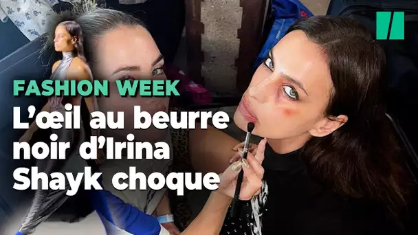 Irina Shayk défile avec un œil au beurre noir et est accusée de glorifier les violences conjugales