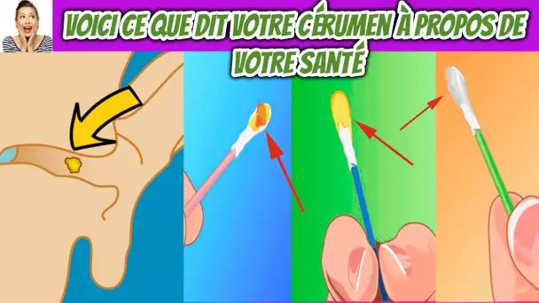 La couleur du cérumen indiquer votre santé, n&#039;ignore jamais ces signes