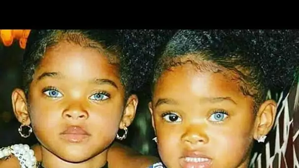 Ces jumelles noires de peau aux yeux bleus  les revoici aujourd’hui après 8 ans !!