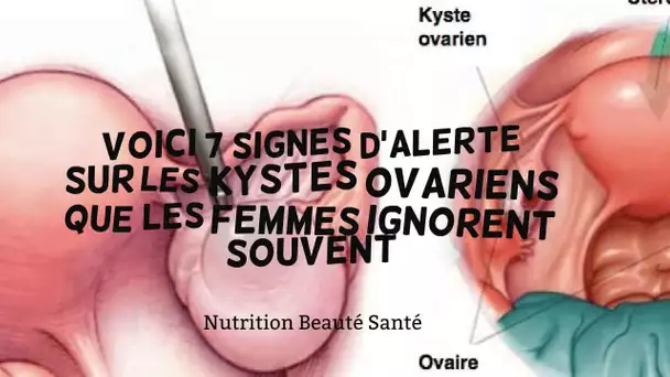 Voici 7 signes d’alerte sur les kystes ovariens que les femmes ignorent souvent