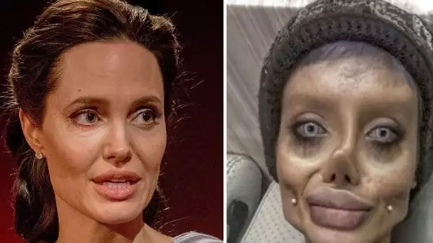 Cette femme subit 50 opérations chirurgicales pour ressembler à Angelina Jolie