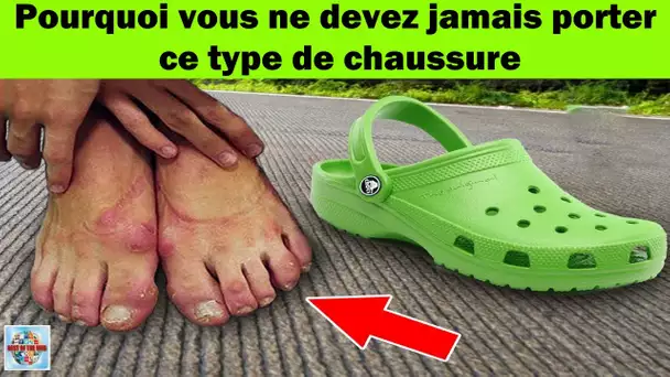 Pourquoi vous ne devez jamais porter ce type de chaussures