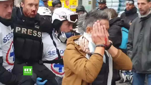 Un journaliste blessé au visage lors de l'acte 53 des Gilets jaunes