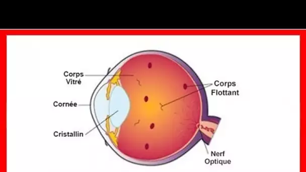 Que sont ces choses étranges que vous voyez flotter dans votre oeil?