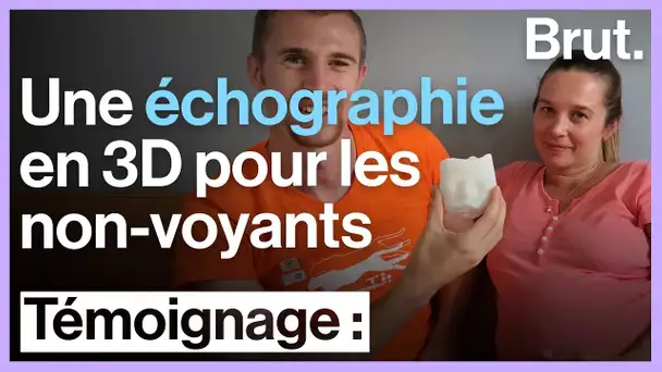 Échographie : non-voyant, il découvre son bébé via une modélisation 3D