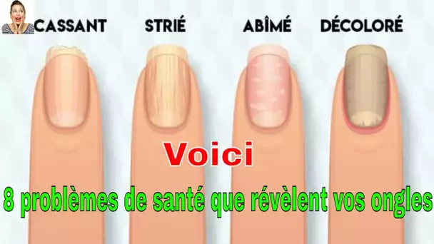 Que disent vos ongles sur votre état de santé ? Voici 8 avertissements à ne pas ignorer