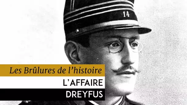 Les Brûlures de l&#039;Histoire - L&#039;affaire Dreyfus