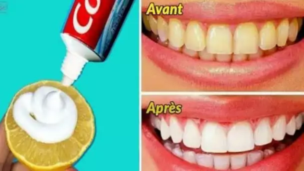 En seulement 2 minutes, les dents sales jaunes deviendront blanches et brillantes