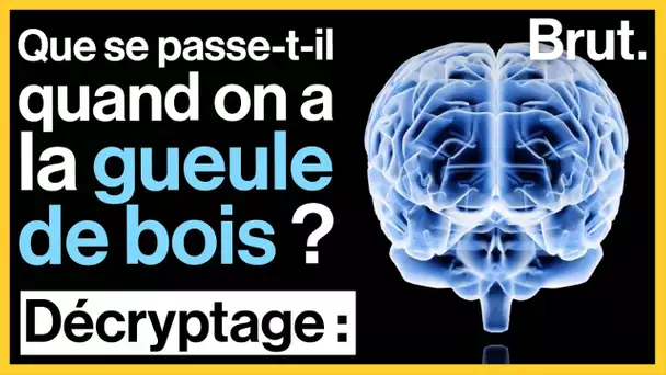 Que se passe-t-il dans notre cerveau quand on a la gueule de bois ?