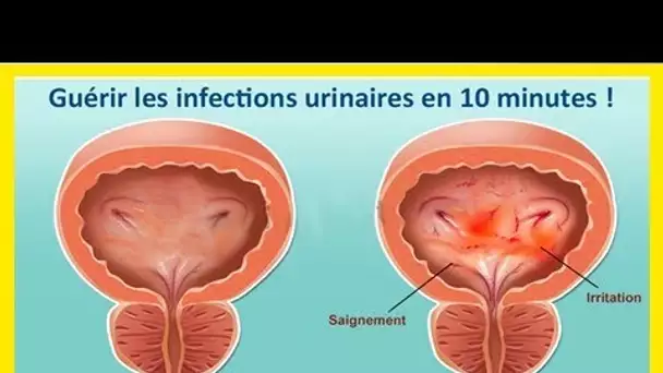 Guérir les infections urinaires en 10 minutes !