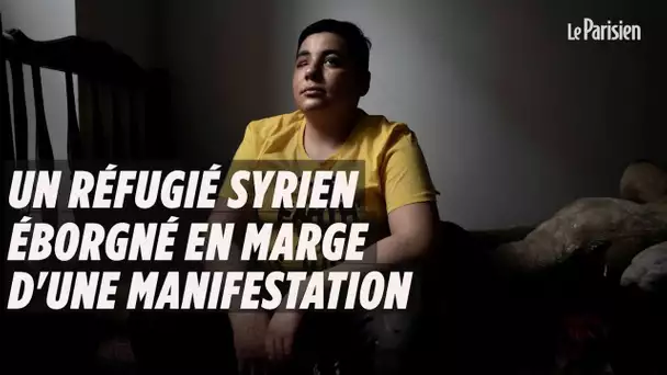 Gilets jaunes : un réfugié syrien éborgné en marge d&#039;une manifestation