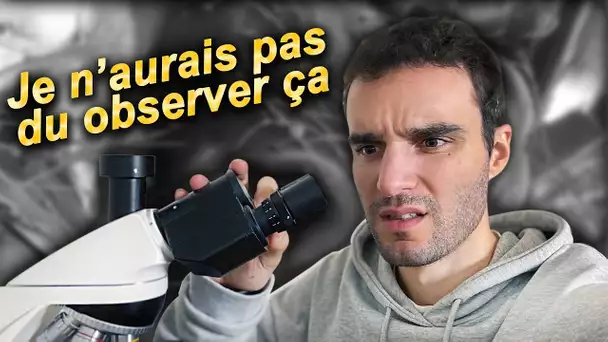 Je n'aurais jamais du observer ça ! (c'est flippant)