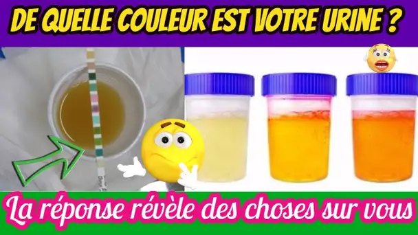 De quelle couleur est votre urine ? La réponse révèle des choses sur vous