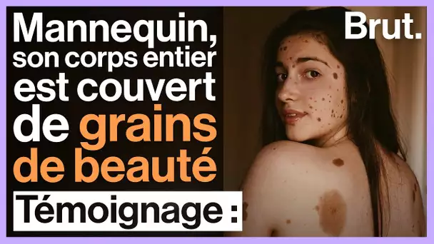 Alba Parejo, mannequin espagnole au corps recouvert de grains de beauté