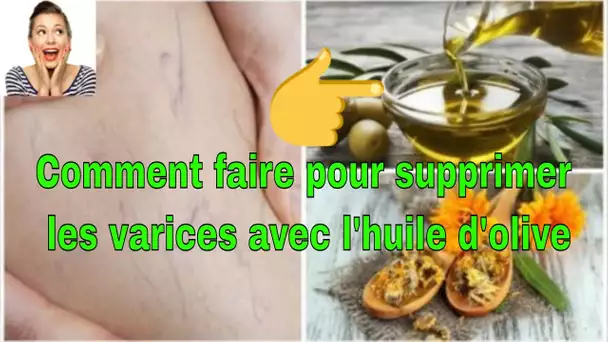 Comment faire pour supprimer les varices avec l&#039;huile d&#039;olive