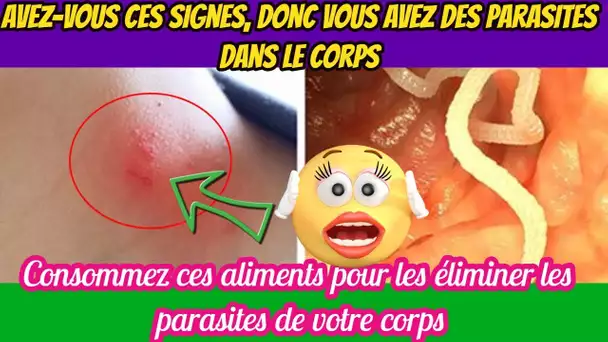 Avez-Vous Ces Signes ? Donc Vous Avez Des Parasites Dans Le Corps.  Consommez Alors Ces Aliments.