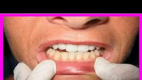 Voici ce qui arrive à vos dents si vous les brossez avec du sel marin et du bicarbonate de soude …