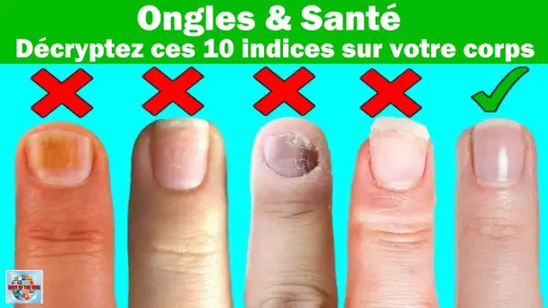 Voici 10 choses que vos ongles disent de votre santé