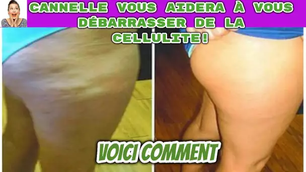 Cannelle cette épice magique qui vous aidera à vous débarrasser de la cellulite!