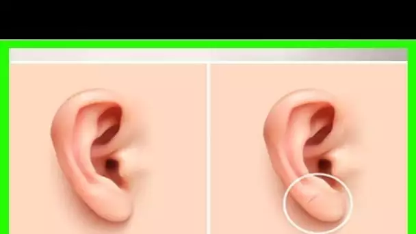 ATTENTION : Si vous voyez un pli sur le lobe de votre oreille, votre santé serait peut-être en DANG