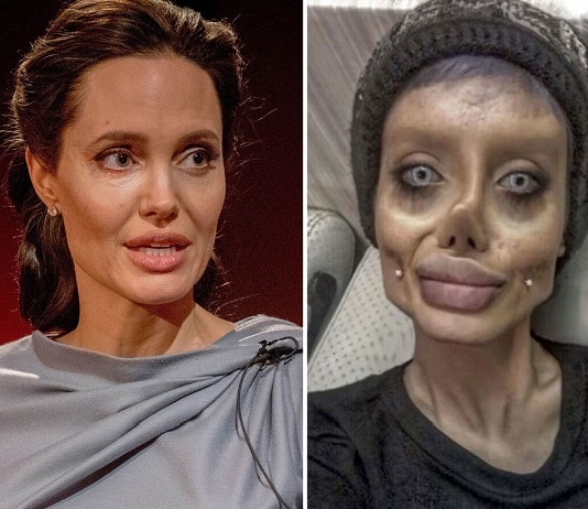 Cette femme subit 50 opérations chirurgicales pour ressembler à Angelina Jolie